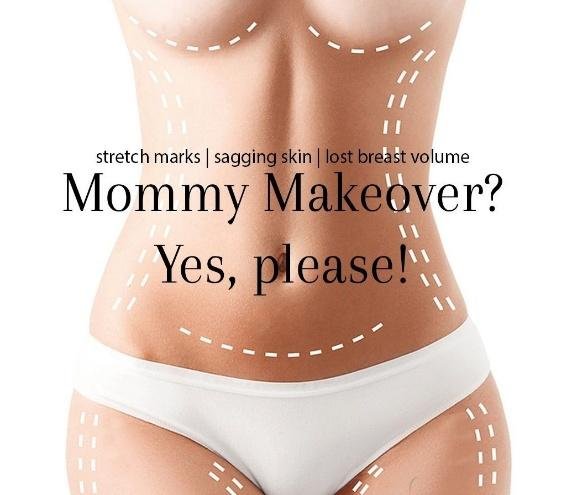Mommy Makeover, grafika poglądowa